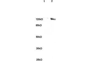 L1 rat brain, L2 human colon carcinoma lysates probed (ABIN741705) at 1:200 in 4 °C. (SREBF2 Antikörper)