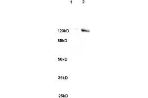 L1 rat brain, L2 human colon carcinoma lysates probed (ABIN741705) at 1:200 in 4 °C. (SREBF2 Antikörper)