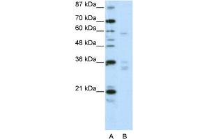 WB Suggested Anti-ZNF440 Antibody Titration:  2.