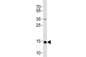 Western blot analysis of lysate from HeLa cell line using FIS1 antibody diluted at 1:1000. (Fission 1 Antikörper  (N-Term))