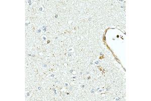 Immunohistochemistry of paraffin-embedded human brain using MMP7 Rabbit mAb (ABIN7268425) at dilution of 1:150 (40x lens). (MMP7 Antikörper)