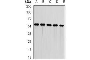 Western blot analysis of DNAJA3 expression in Jurkat (A), HepG2 (B), mouse kidney (C), mouse heart (D), rat liver (E) whole cell lysates.