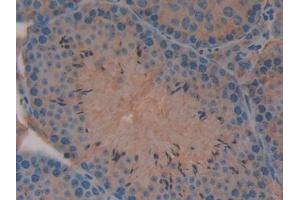 Immunohistochemistry (IHC) image for anti-E3 ubiquitin-protein ligase MIB2 (MIB2) (AA 546-784) antibody (ABIN7439507)