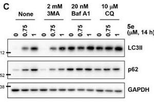 Western Blotting (WB) image for anti-Glyceraldehyde-3-Phosphate Dehydrogenase (GAPDH) antibody (ABIN2857072)