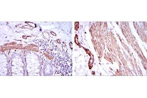 Immunohistochemical analysis of paraffin-embedded human duodenum tissues (left) and human esophagus tissues (right) using ACTA2 mouse mAb with DAB staining. (Smooth Muscle Actin Antikörper)