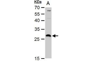 WB Image DCK antibody detects DCK protein by western blot analysis.