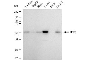 anti-Membrane Protein, Palmitoylated 1, 55kDa (MPP1) antibody