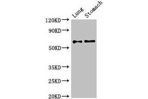 Western Blot Positive WB detected in: Mouse lung tissue, Mouse stomach tissue All lanes: GAD2 antibody at 2. (GAD65 Antikörper  (AA 1-82))
