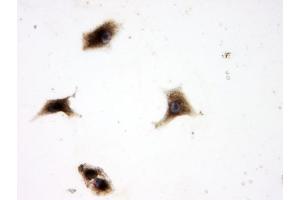 IHC analysis of SQSTM1 using anti-SQSTM1 antibody (ABIN3043937). (SQSTM1 Antikörper  (N-Term))