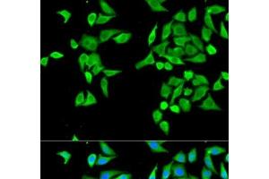 Immunofluorescence analysis of MCF-7 cells using CES2 Polyclonal Antibody (CES2 Antikörper)