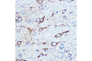 Immunohistochemistry of paraffin-embedded mouse brain using NMD Rabbit pAb (ABIN6133733, ABIN6141400, ABIN6141403 and ABIN6223602) at dilution of 100 (40x lens). (GRIN1/NMDAR1 Antikörper  (AA 600-700))