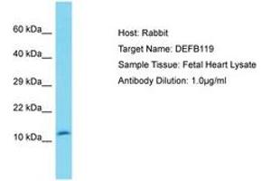 Image no. 1 for anti-Defensin, beta 119 (DEFB119) (N-Term) antibody (ABIN6750557) (DEFB119 Antikörper  (N-Term))