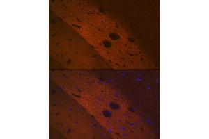 Immunofluorescence analysis of rat brain using mGluR2 Rabbit mAb (ABIN1682570, ABIN3017965, ABIN3017966 and ABIN7101551) at dilution of 1:100 (40x lens). (GRM2 Antikörper)