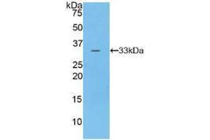 Western blot analysis of recombinant Human PKN1. (PKN1 Antikörper  (AA 615-874))