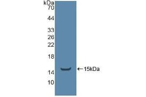 Western blot analysis of recombinant Human ADRbK1. (TEK Antikörper  (AA 1-116))