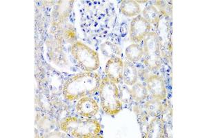 Immunohistochemistry of paraffin-embedded rat kidney using UPF2 antibody. (RENT2/UPF2 Antikörper)