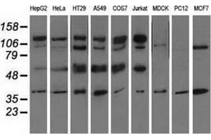 Western blot analysis of extracts (35 µg) from 9 different cell lines by using anti-CD5 monoclonal antibody. (CD5 Antikörper)