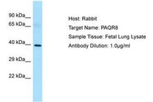 Image no. 1 for anti-Progestin and AdipoQ Receptor Family Member VIII (PAQR8) (C-Term) antibody (ABIN6750064)
