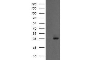 Image no. 1 for anti-Proteasome Subunit alpha 2 (PSMA2) (AA 50-234) antibody (ABIN1491568) (PSMA2 Antikörper  (AA 50-234))