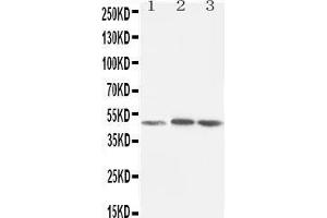 Anti-LXR alpha antibody, Western blotting Lane 1: Rat Liver Tissue Lysate Lane 2: MCF-7 Cell Lysate Lane 3: HELA Cell Lysate