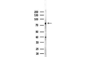 Western blot analysis of lysates from RAW264. (SLCO4A1 Antikörper)