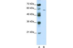 Western Blotting (WB) image for anti-BTB (POZ) Domain Containing 14A (BTBD14A) antibody (ABIN2461017) (BTBD14A Antikörper)