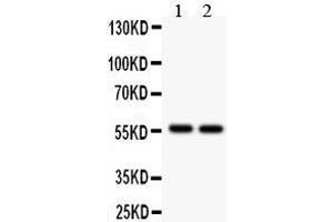 Anti- ALDH2 Picoband antibody, Western blotting All lanes: Anti ALDH2  at 0.