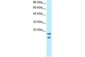 Western Blotting (WB) image for anti-C-Myc Binding Protein (MYCBP) antibody (ABIN2460298)