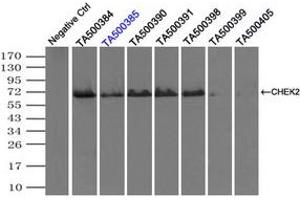 Image no. 1 for anti-Checkpoint Kinase 2 (CHEK2) antibody (ABIN1497498) (CHEK2 Antikörper)