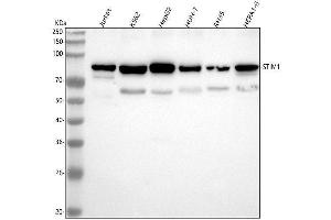 Western blot analysis of STIM1 using anti-STIM1 antibody (ABIN7606404).