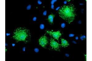 Anti-KATNB1 mouse monoclonal antibody (ABIN2455205) immunofluorescent staining of COS7 cells transiently transfected by pCMV6-ENTRY KATNB1 (RC201852). (KATNB1 Antikörper)
