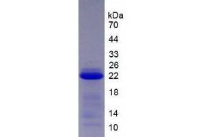 SDS-PAGE analysis of Human SCCA2 Protein. (SERPINB4 Protein)