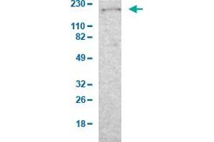 Western Blot analysis of human cell line RT-4. (Laminin beta 1 Antikörper  (AA 652-790))
