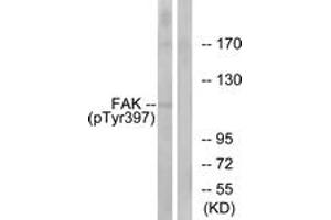 Western blot analysis of extracts from 293 cells treated with EGF 200ng/ml 30', using FAK (Phospho-Tyr397) Antibody. (FAK Antikörper  (pTyr397))