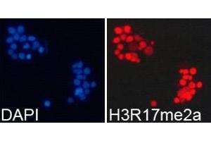 Immunofluorescence analysis of 293T cell using H3R17me2a antibody. (Histone 3 Antikörper  (H3R17me2a))