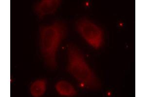 Immunofluorescence staining of methanol-fixed Hela cells using Phospho-LIMK1-T508 antibody. (LIM Domain Kinase 1 Antikörper  (pThr508))