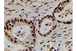 Immunohistochemistry (IHC) image for anti-LIM Domain Kinase 1 (LIMK1) (pThr508) antibody (ABIN6255701)
