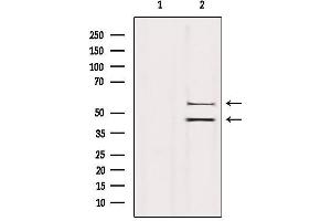 Western Blotting (WB) image for anti-Mitogen-Activated Protein Kinase 8 (MAPK8) antibody (ABIN6262710)