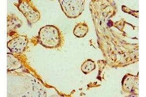 Immunohistochemistry (IHC) image for anti-Solute Carrier Family 2 (Facilitated Glucose Transporter), Member 2 (SLC2A2) (AA 235-485) antibody (ABIN7170006)