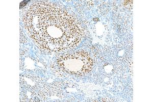 Immunohistochemistry (IHC) image for anti-Poly (ADP-Ribose) Polymerase 1 (PARP1) (AA 750-800) antibody (ABIN7449457)
