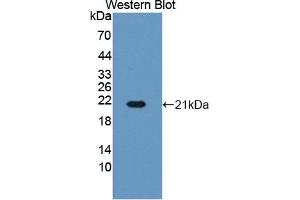 Detection of Recombinant HBb, Bovine using Polyclonal Antibody to Hemoglobin Beta (HBb) (Hemoglobin Subunit beta Antikörper  (AA 1-145))