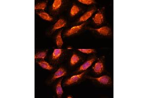 Immunofluorescence analysis of U-2 OS cells using RA antibody (ABIN7269798) at dilution of 1:100. (RAB1A Antikörper  (AA 1-205))