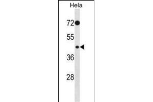 Western Blotting (WB) image for anti-phosphorylase Kinase, gamma 2 (Testis) (PHKG2) (AA 41-71), (N-Term) antibody (ABIN391341)
