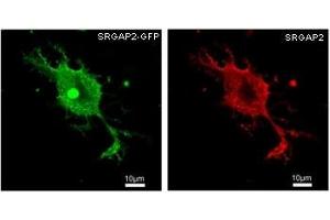 HEK293 overexpressing human SRGAP2 and probed with GFP (green) and SRGAP2 (red) antibody at 2. (SRGAP2 Antikörper)