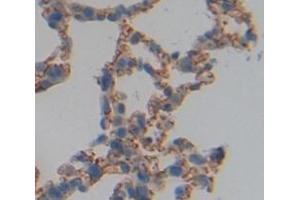 Figure. (IL3RA Antikörper  (AA 17-166))