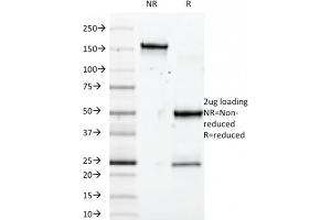 SDS-PAGE Analysis Purified SOX10 Mouse Monoclonal Antibody (SOX10/992). (SOX10 Antikörper  (AA 115-269))