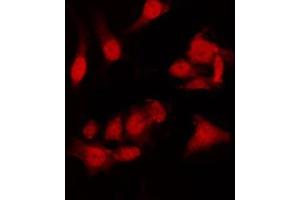 ABIN6275007 staining HT29 by IF/ICC. (CLIC4 Antikörper  (N-Term))