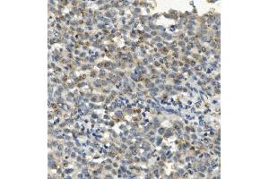 IHC analysis of CCR2 using anti-CCR2 antibody (ABIN7598970). (CCR2 Antikörper  (AA 1-125))