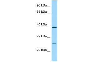 WB Suggested Anti-P2RY14 Antibody Titration: 1. (P2RY14 Antikörper  (C-Term))
