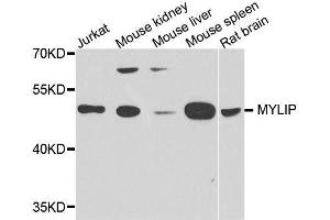 Western blot analysis of extracts of various cell lines, using MYLIP antibody. (MYLIP Antikörper  (AA 266-445))